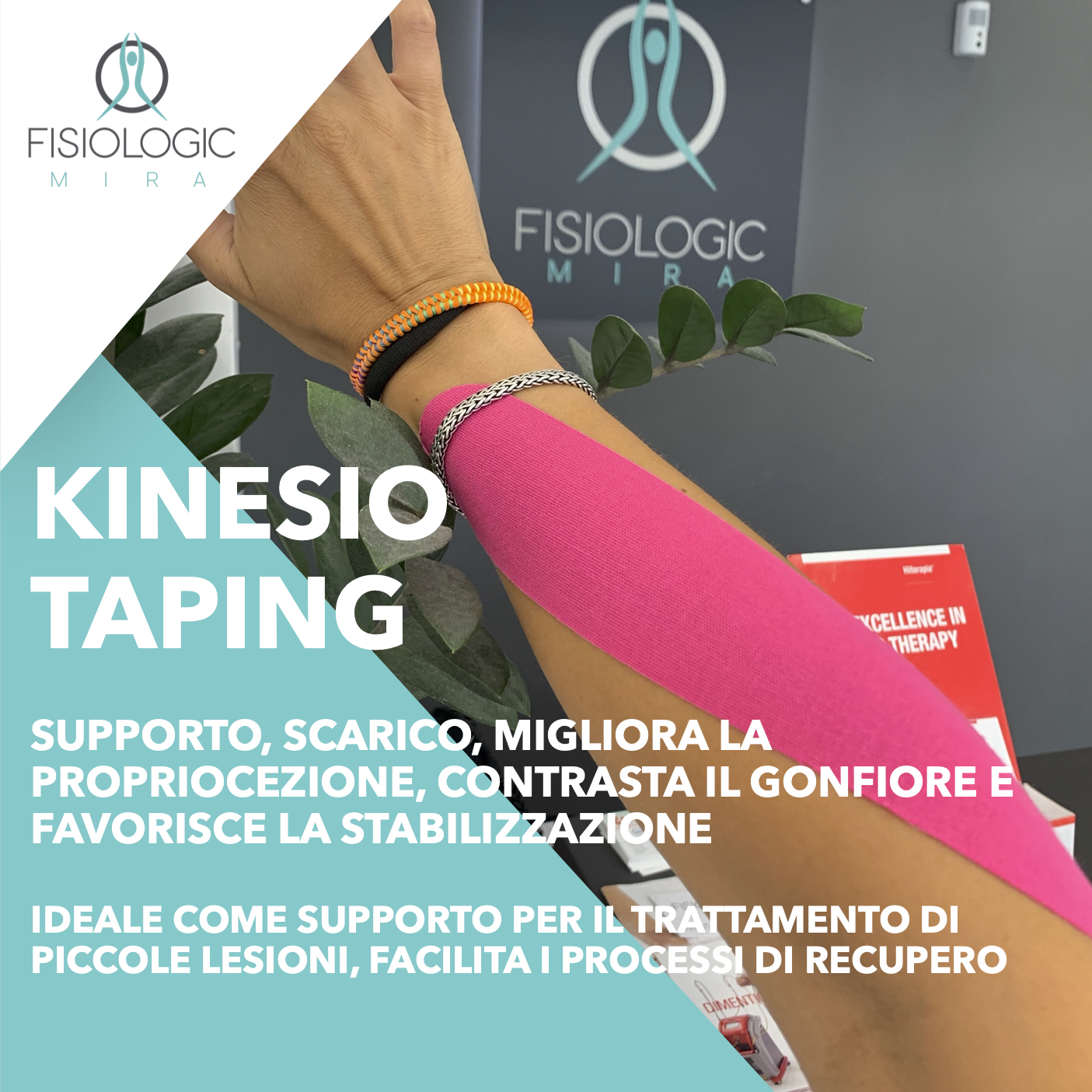 Taping santa maria delle mole marino Kinesio Tape Tecar terapia